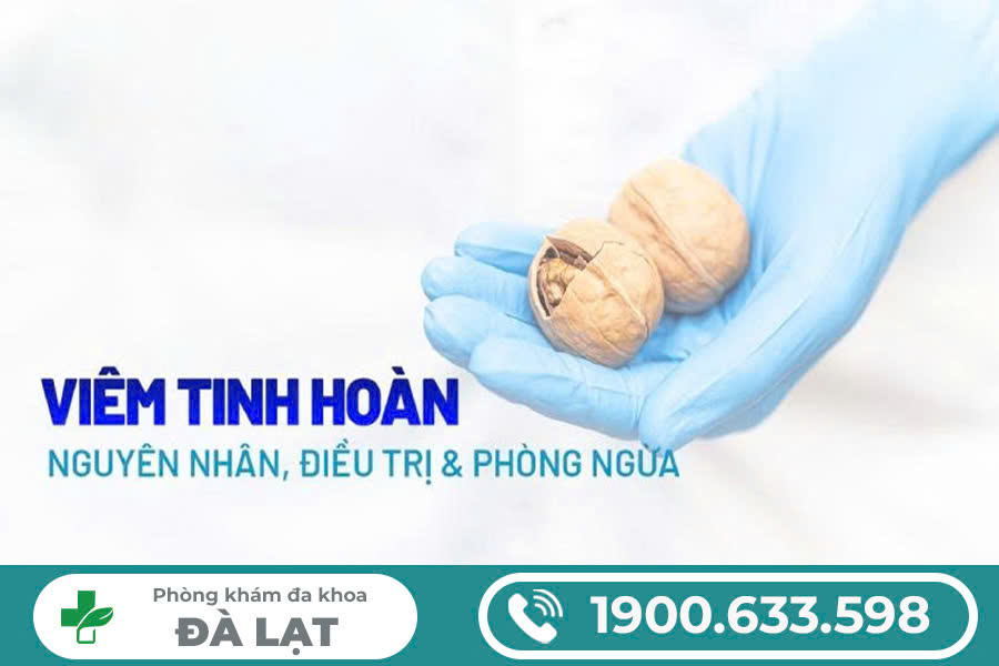 Hình ảnh minh họa